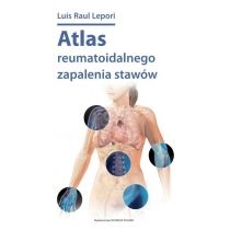 Atlas reumatoidalnego zapalenia stawów