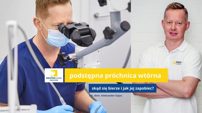 Próchnica pod plombą – na to trzeba uważać!