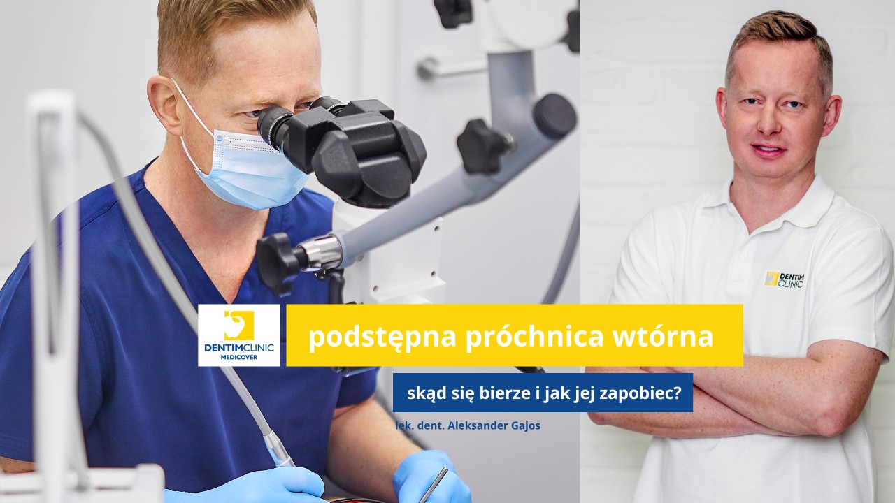Próchnica pod plombą – na to trzeba uważać!